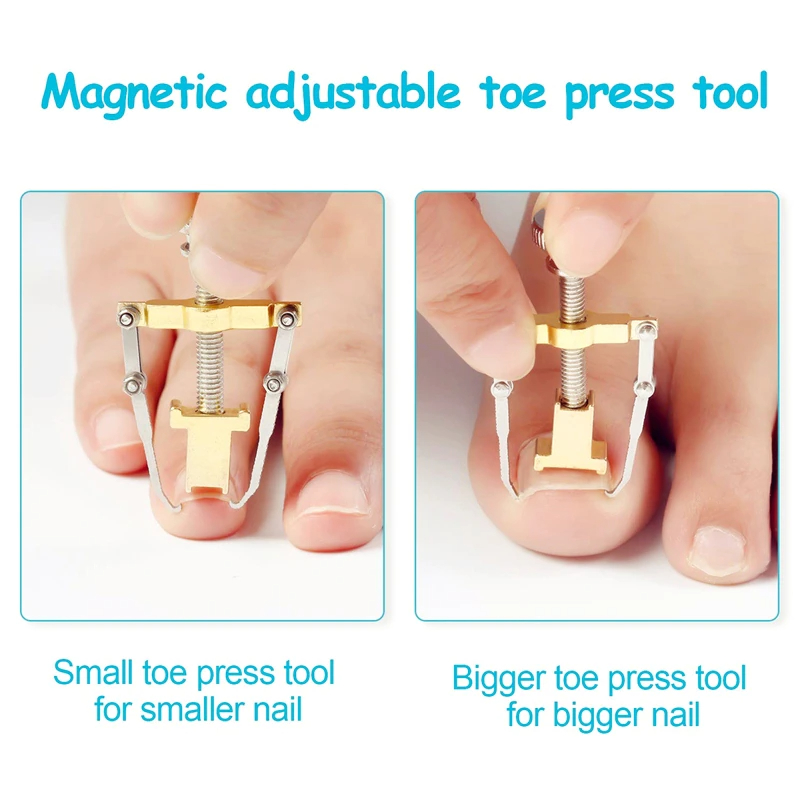 مصحح أظافر القدم لتقويمها وإعادتها لوضعها الطبيعي