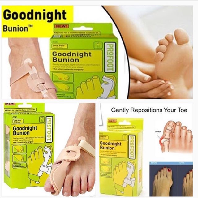 مصحح ومعالج بروز القدم وإعادة تنظيم الأوتار وإعادتها لوضعها الطبيعي