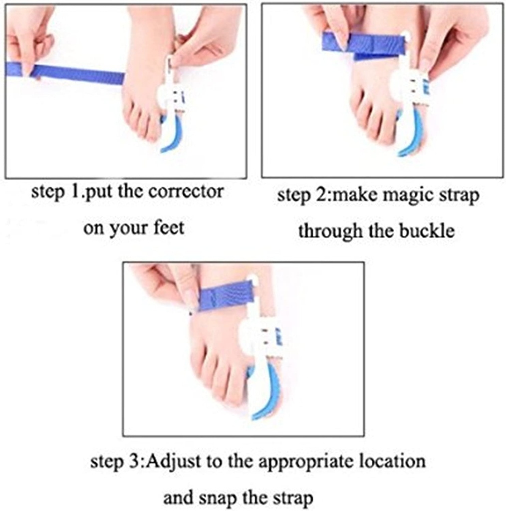 مصحح ومعالج بروز القدم وإعادة تنظيم الأوتار وإعادتها لوضعها الطبيعي