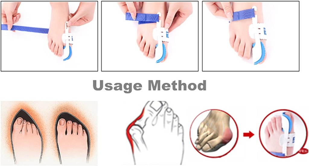 مصحح ومعالج بروز القدم وإعادة تنظيم الأوتار وإعادتها لوضعها الطبيعي